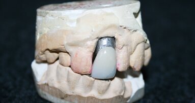 Krunica napravljena za Elvisa Prislija prodata na aukciji