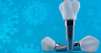 Interview on the impact of SARS-CoV-2 on dental implantology