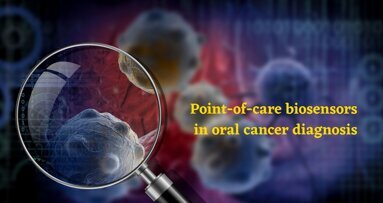Small device, big impact: Biosensors in oral cancer diagnosis