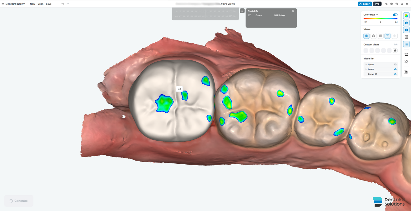 Fig. 4a: Evaluation of the AI-generated crown morphology. Occlusal contact distribution.