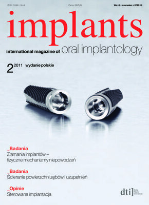 implants Poland No. 2, 2011 implants Poland No. 2, 2011