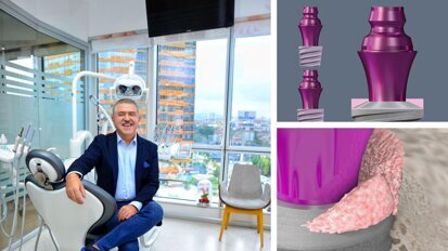 Evolution and revolution: The Bone Growth Concept