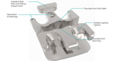 Selección de alambres en ortodoncia digital