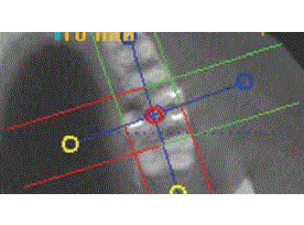 L'utilité du cone beam en endo.