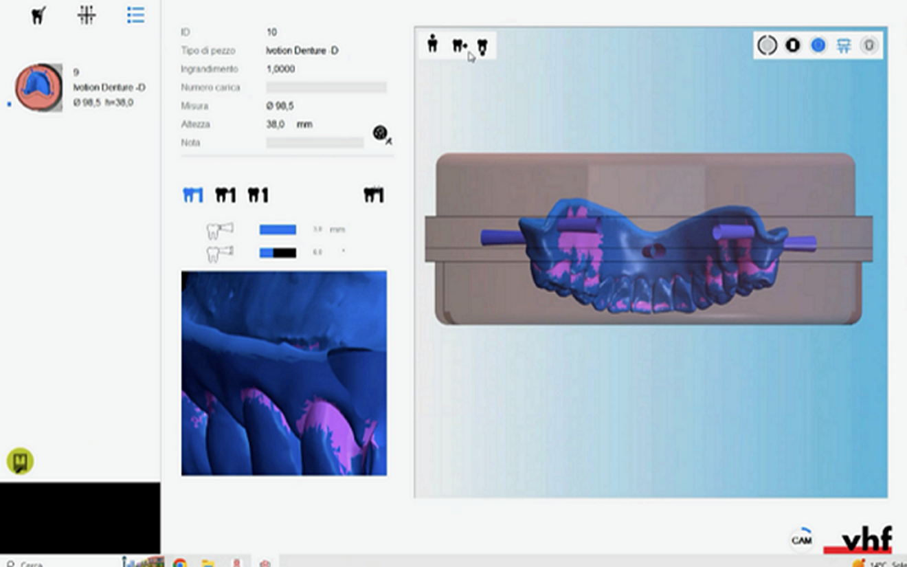 Fig. 8: Denture in the vhf CAM software module for the R5.