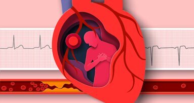 Unbehandelte Parodontitis kann zur Entzündung der Herzinnenhaut führen