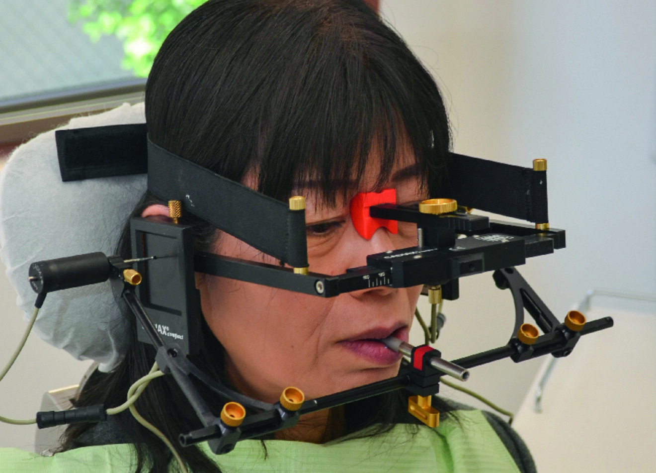 Fig. 3a : De nombreuses données sur la patiente sont obtenues au moyen de l’arc facial.