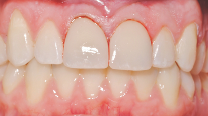 CAD/CAM technology: Setting the standard and achieving success