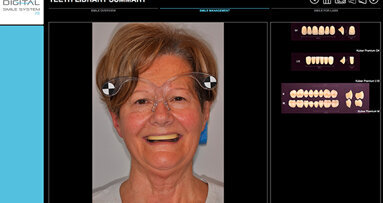 EGS ad IDS 2015: ecco le ultime novità CAD/CAM per il Digital Dentistry