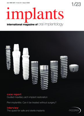implants international No. 1, 2023 implants international No. 1, 2023