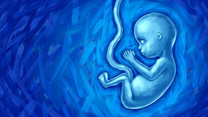 Study examines oral health of individuals with foetal alcohol spectrum disorder