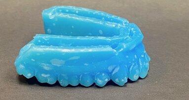 3D printing’s place in today’s dental practice