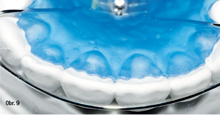 Postup práce s Orthocryl LC