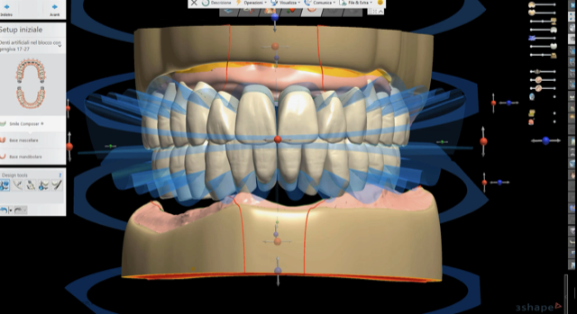 Fig. 7_La Shell Geometry caratteristica unica del disco Ivoclar Ivorion compatibile con il fresatore vhf R5.