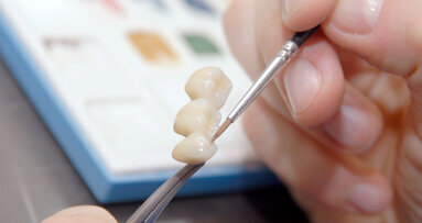 Beste Prothetik-Dissertation gesucht