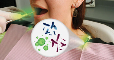 Unsterilized bib chains may cause crosscontamination