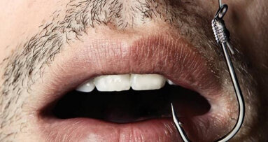 El catastrófico boom de los diseños de sonrisa