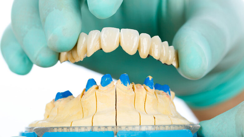 Coronavirus: Gefahr durch Zahnersatz aus China?