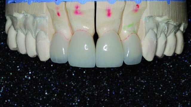 Photographie numérique dentaire – Partie II - Proposition de protocole de prises de vues pour des bilans plus pratiques, plus rapides et plus efficaces en dentisterie cosmétique