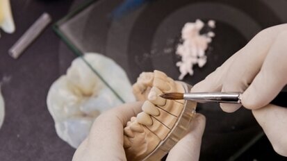 Diş Teknisyenleri Yıpranma Paylarını İstiyorlar