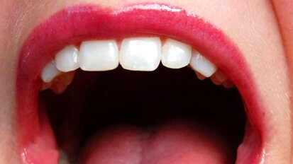 Academy of Laser Dentistry partners with OralID to raise awareness of oral cancer Academy of Laser Dentistry partners with OralID to raise awareness of oral cancer