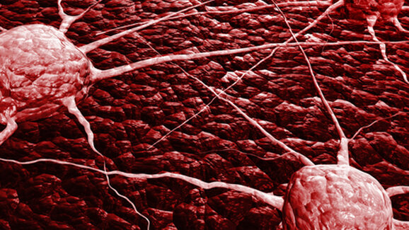 Selbstkontrolle des Immunsystems dämpft Krebsabwehr
