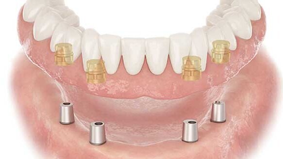 Do you know enough about the implant company you work with?