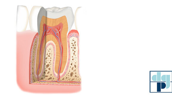 Behandlungschancen bei Parodontitis und Diabetes