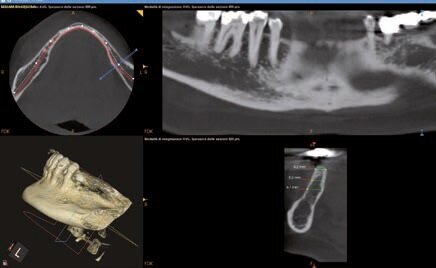 Fig. 3 - Misurazioni in sede 37.