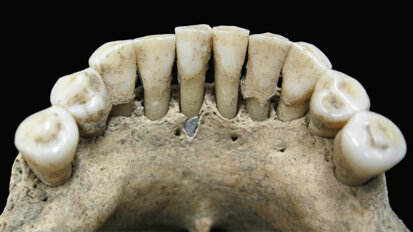 Das verrät Zahnstein über die Rolle der Frau im Mittelalter Das verrät Zahnstein über die Rolle der Frau im Mittelalter