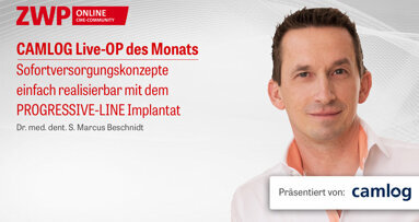 1 CME-Punkt: CAMLOG Live-OP mit Dr. Beschnidt jetzt im Archiv
