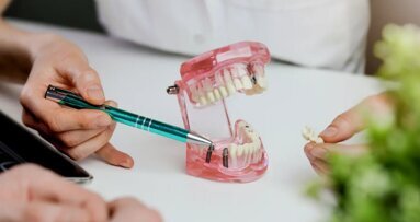 Ранни микробни детерминанти на периимплантното здраве, открити в ново проучване