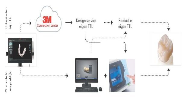 DITARE: nieuwe optie tussen vulling en kroon