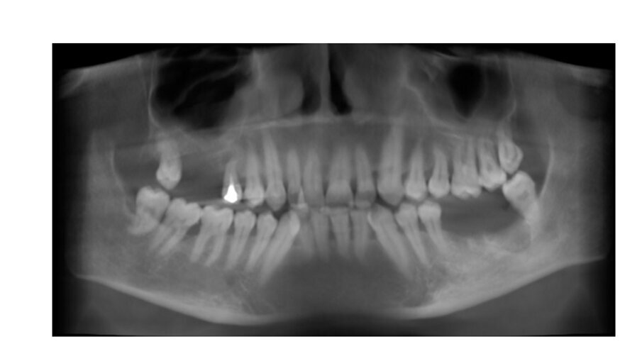 Fig. 1_CBCT iniziale.