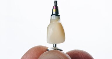 Veel enkelvoudige implantaten functioneren ook na veertig jaar nog