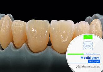 Zolid Gen-X - Universal Excellence
