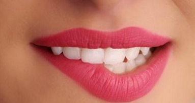 Solcoseryl pasta za usnu sluznicu – terapija inflamatornih, ulcerativnih i bolnih rana u ustima