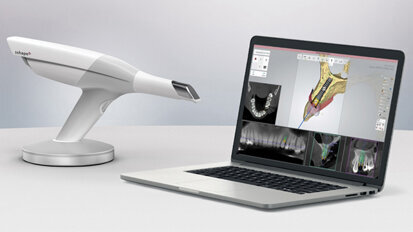 Sólo implantát: Náhrada horního premoláru pomocí digitálního pracovního postupu