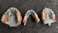 From weeks to days: Dental laboratory halves production time for removable partial dentures