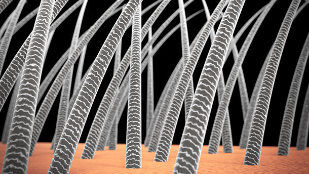 Ricerca: scoperto un legame fra problemi di capelli e carie dentali