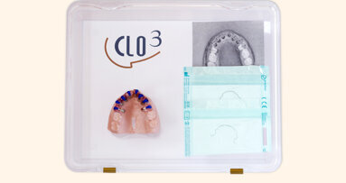 Ortodoncia lingual personalizada en tres pasos