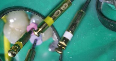 Problèmes endodontiques pressants