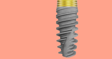 “Science, stability, success”: Dr Graham Carmichael discusses Xeal and TiUltra surfaces