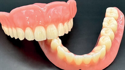 3D-printed 28-tooth complete dentures: A modern approach to dental solutions
