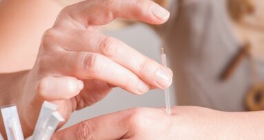 Akupunktura: Hledá cestu do stomatologie – Část I