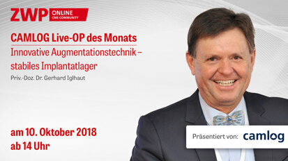 CAMLOG Live-OP am 10. Oktober ab 14 Uhr CAMLOG Live-OP am 10. Oktober ab 14 Uhr