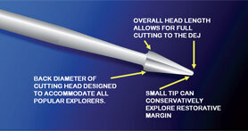 La preparación del perímetro