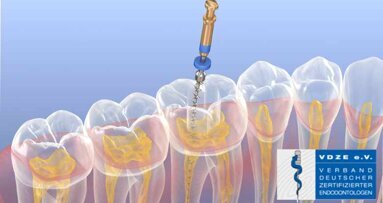 Aufruf zur Falleinreichung für den Endo-Award 2022