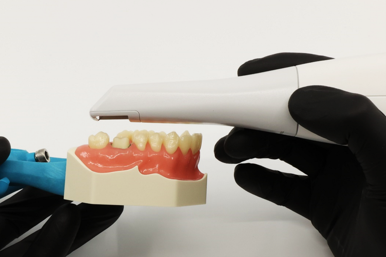 Fig. 4: How to hold an intra-oral scanner in a pen grip.