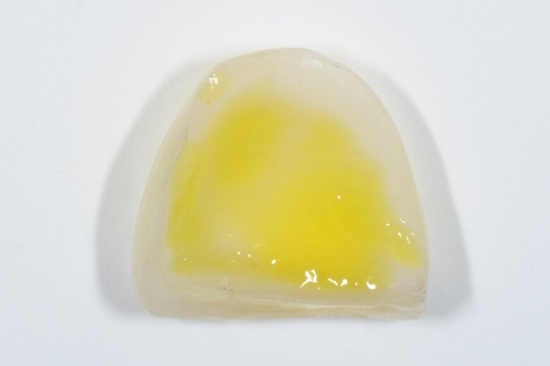 Fig. 16 Etching of the lithium disilicate veneers with hydrogen fluoride.